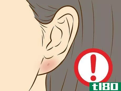 Image titled Get Your Ears Pierced Step 17