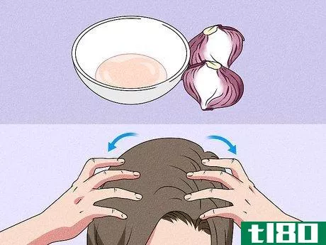 Image titled Increase Blood Circulation in Your Scalp Step 7