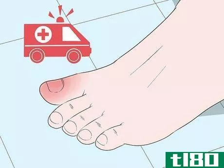 Image titled Heal a Bruised Toe Step 12