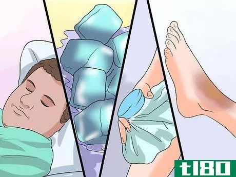 Image titled Heal a Hematoma Step 1