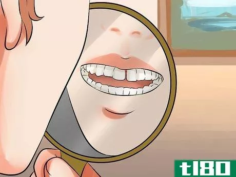 Image titled Get Rid of Gaps in Teeth Step 2