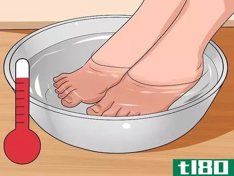 Image titled Get Rid of Bunions Step 7