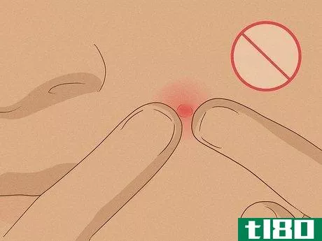 Image titled Get Rid of Pimples Naturally (Sea Salt Method) Step 8