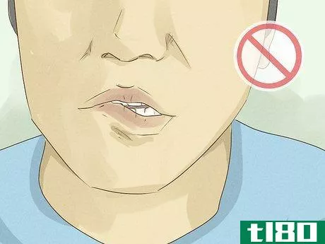 Image titled Heal Lips After Biting Them Step 1