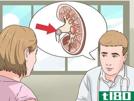 Image titled Know if You Have Kidney Stones Step 12