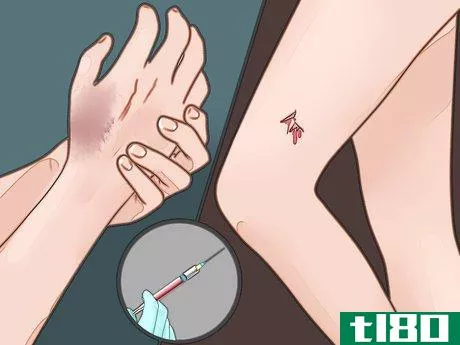 Image titled Know when You Need a Tetanus Shot Step 1