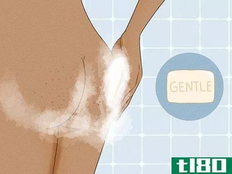Image titled Get Rid of Acne on the Buttocks Step 14