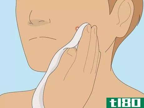 Image titled Get Rid of a Pimple Using Toothpaste Step 10