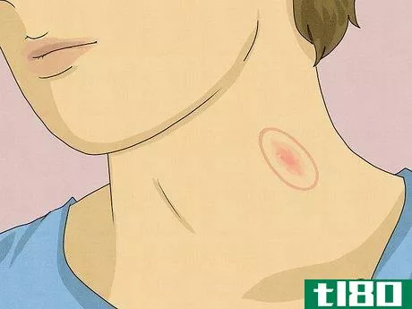 Image titled Identify a Hickey Step 2