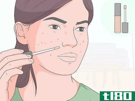Image titled Get Rid of Acne Scars at Home Without Chemicals Step 6