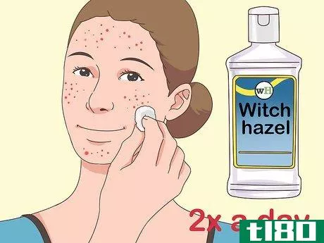 Image titled Get Rid of Acne Fast Step 7