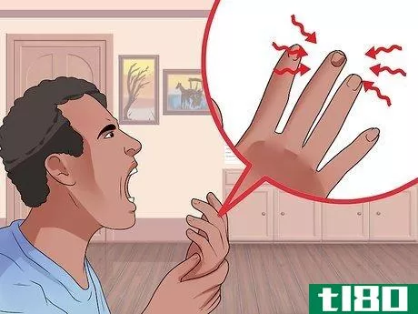 Image titled Know if You Have Nail Fungus Step 5