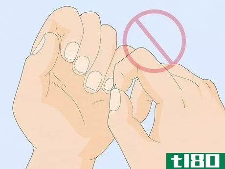 Image titled Get Rid of White Spots on Your Nails Step 9