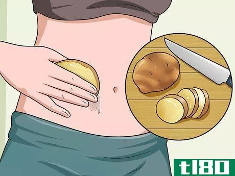 Image titled Get Rid of Stretch Marks Fast Step 5