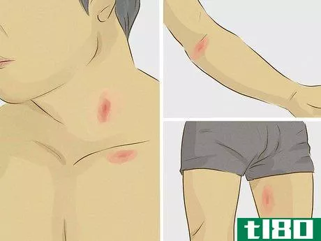 Image titled Give Someone a Hickey Step 5