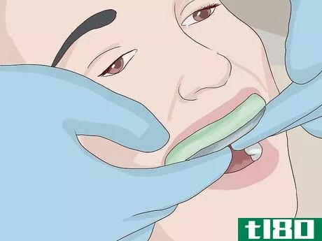 Image titled Know What to Expect when Getting a Tooth Implant Step 16