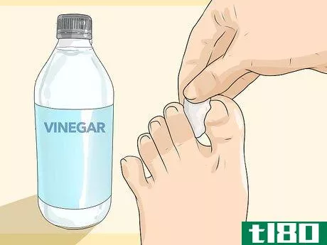 Image titled Get Rid of Calluses Step 10