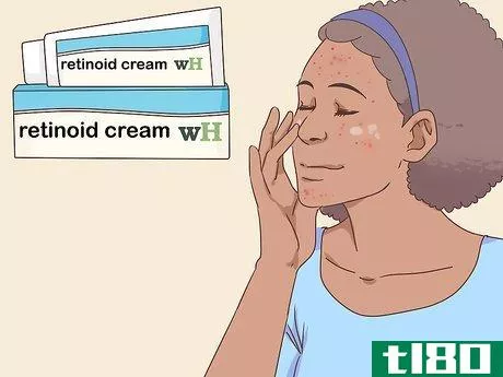 Image titled Get Rid of Acne Fast Step 4