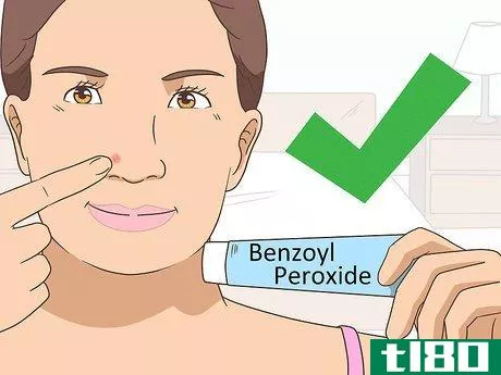 Image titled Get Rid of a Pimple Step 5