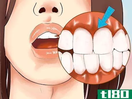 Image titled Heal Mouth Inflammation Step 10