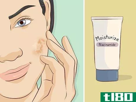 Image titled Get Rid of Brown Spots Using Home Remedies Step 5