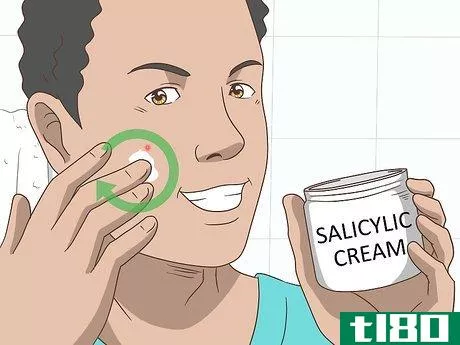 Image titled Get Rid of a Pimple Step 4