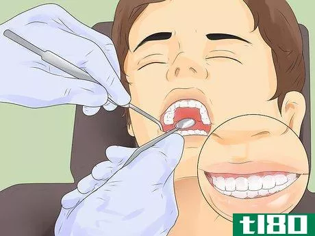 Image titled Get Rid of White Spots on Teeth Step 7