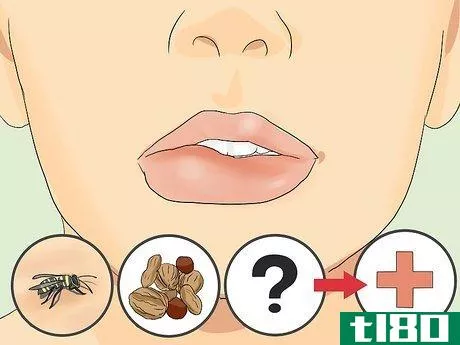 如何治好肿胀的嘴唇(heal a swollen lip)