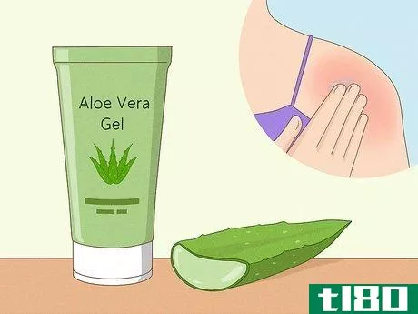 Image titled Get Rid of Itchy Skin with Home Remedies Step 6