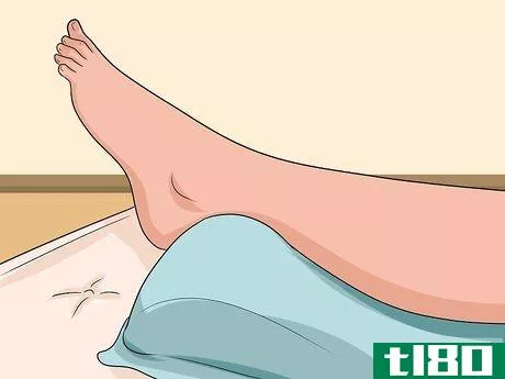 Image titled Know if You've Sprained Your Ankle Step 11