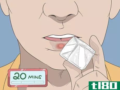 Image titled Get Rid of a Cold Sore with Home Remedies Step 8