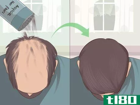 Image titled Hide Alopecia Step 4