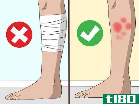 Image titled Heal Red Skin Step 2