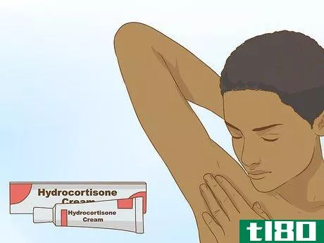 Image titled Get Rid of a Zit on Your Armpit Step 12