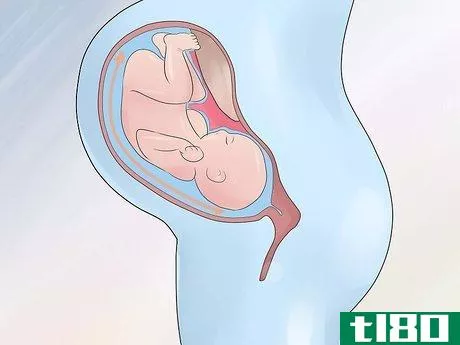 Image titled Increase Amniotic Fluid Step 13