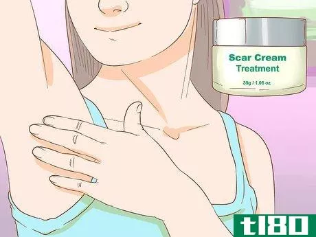 Image titled Get Rid of Boil Scars Step 1