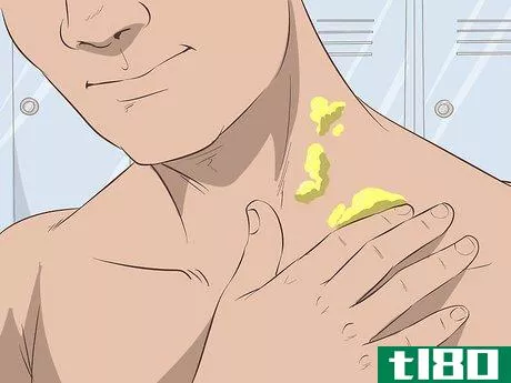 Image titled Get Rid of Neck Acne Step 15