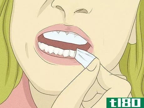 Image titled Get Whiter Teeth at Home Step 5