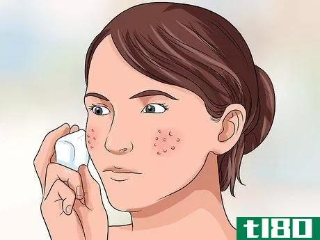 Image titled Get Rid of Large Pores and Blemishes Step 2