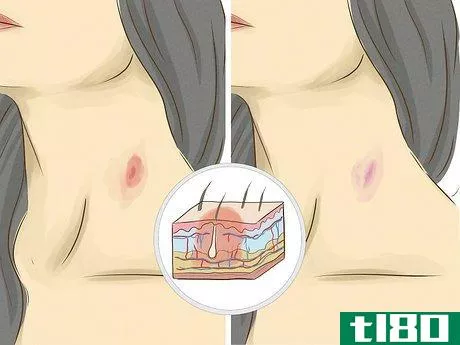 Image titled Give Someone a Hickey Step 1