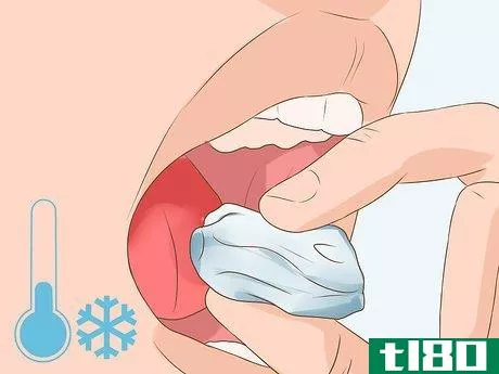 Image titled Heal a Bitten Tongue Step 5