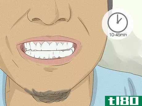 Image titled Get Whiter Teeth at Home Step 4