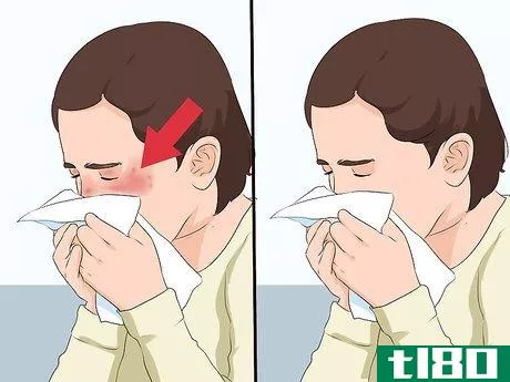 Image titled Identify a Seasonal Allergy Reaction in Young Children Step 7