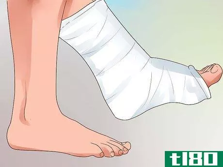 Image titled Heal a Broken Toe Step 10