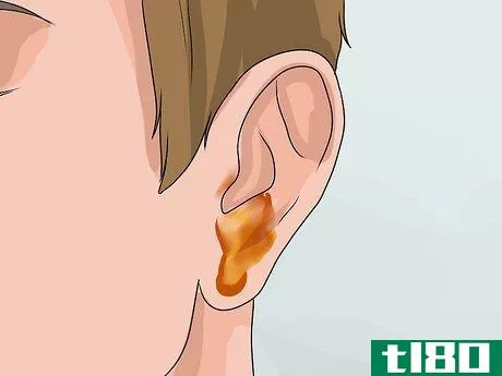 Image titled Know if You Have Otitis Media Step 3