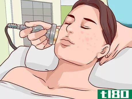 Image titled Get Rid of a Hard Pimple Step 23