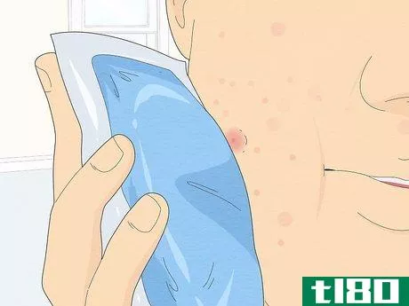 Image titled Get Rid of a Popped Pimple Overnight Step 11