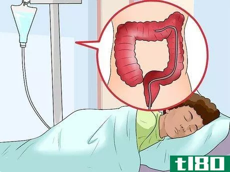 Image titled Help Chronic Indigestion Step 25