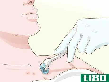 Image titled Get Rid of Acne Scars on Your Chest Step 2
