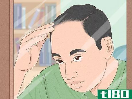 Image titled Know if You Have Male Pattern Baldness Step 11